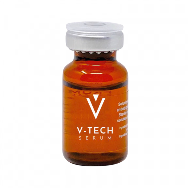 V Tech System - Image 3