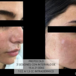 Trattamenti B&A 3